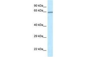 Image no. 1 for anti-RAS Guanyl Releasing Protein 4 (RASGRP4) (AA 149-198) antibody (ABIN6747687)