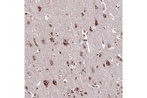 Immunohistochemical staining of human cerebral cortex with PDS5B polyclonal antibody  at 1:200-1:500 dilution. (PDS5B anticorps)