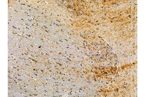 ABIN7095021 and ABIN7099077 at 1/100 staining rat brain tissue by IHC-P. (PI15 anticorps)