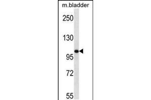Western blot analysis in mouse bladder tissue lysates (35ug/lane). (TLR8 anticorps  (C-Term))
