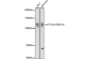 Western blot analysis of extracts of various cell lines, using  / SERC antibody (ABIN3021429, ABIN3021430, ABIN3021431 and ABIN6215028) at 1:10000 dilution.