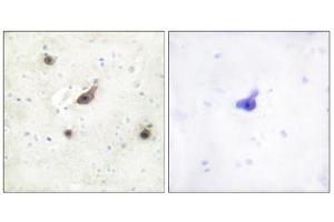 Immunohistochemistry analysis of paraffin-embedded human brain tissue using B-RAF antibody.