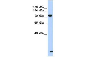Western Blotting (WB) image for anti-Trinucleotide Repeat Containing 6B (TNRC6B) antibody (ABIN2458485) (TNRC6B anticorps)