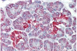 Human Pancreas (formalin-fixed, paraffin-embedded) stained with SLC39A5 antibody ABIN462243 followed by biotinylated goat anti-rabbit IgG secondary antibody ABIN481713, alkaline phosphatase-streptavidin and chromogen.