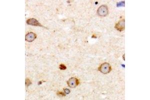 Immunohistochemical analysis of ME3 staining in human brain formalin fixed paraffin embedded tissue section. (ME3 anticorps  (C-Term))