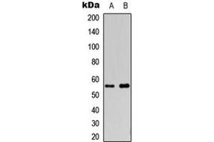 Western blot analysis of Cytochrome P450 2S1 expression in HepG2 (A), COLO205 (B) whole cell lysates. (CYP2S1 anticorps  (Center))