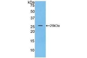 Detection of Recombinant CX43, Rat using Polyclonal Antibody to Connexin 43 (CX43) (Connexin 43/GJA1 anticorps  (AA 180-382))