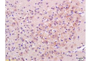 Formalin-fixed and paraffin embedded rat brain labeled with Rabbit Anti H Cadherin/T cadherin Polyclonal Antibody, Unconjugated (ABIN715271) at 1:200 followed by conjugation to the secondary antibody and DAB staining (Cadherin 13 anticorps  (AA 301-400))