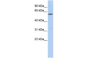 WB Suggested Anti-CEACAM16 Antibody Titration:  0.