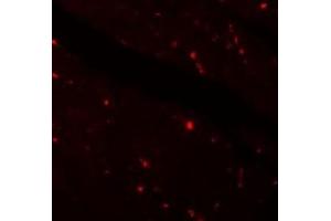 Immunofluorescence of KLOTOH in mouse heart tissue with KLOTHO antibody at 20 ug/ml.