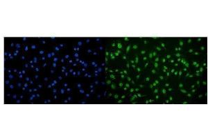 IF analysis of CAMKIV/Camk4 using anti-CAMKIV/Camk4 antibody (ABIN7600419). (CAMK4 anticorps  (AA 19-469))
