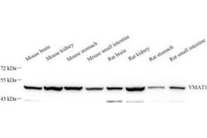 Western blot analysis of VMAT1 (ABIN7075654) at dilution of 1: 1000 (SLC18A1 anticorps)