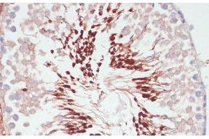 Immunohistochemistry of paraffin-embedded Rat testis using PGK2 Polyclonal Antibody at dilution of 1:100 (40x lens).