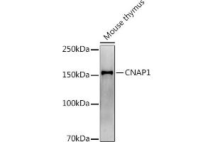 Western blot analysis of extracts of Mouse thymus, using (ABIN7268948) at 1:1000 dilution. (NCAPD2 anticorps)