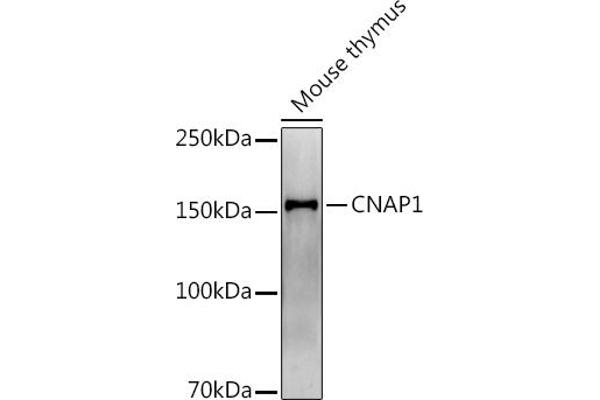NCAPD2 anticorps