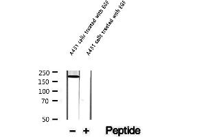 Western blot analysis of extracts of A431 cells treated with EGF, using Phospho-Afadin (Ser1799) Antibody. (Afadin anticorps  (pSer1799))