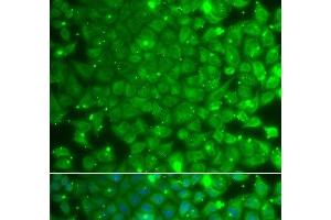Immunofluorescence analysis of A549 cells using KBTBD7 Polyclonal Antibody (KBTBD7 anticorps)