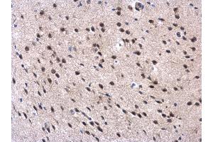 IHC-P Image MPP3 antibody [N1C1] detects MPP3 protein at cytoplasm and nucleus in mouse brain by immunohistochemical analysis. (MPP3 anticorps  (Center))
