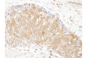 Immunohistochemistry (IHC) image for anti-Chaperonin Containing TCP1, Subunit 3 (Gamma) (CCT3) (AA 495-545) antibody (ABIN7453615)