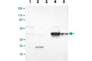 Western Blot analysis of Lane 1: RT-4, Lane 2: U-251MG sp, Lane 3: human plasma (IgG/HSA depleted), Lane 4: human liver and Lane 5: human tonsil lysates with FAM50A polyclonal antibody .