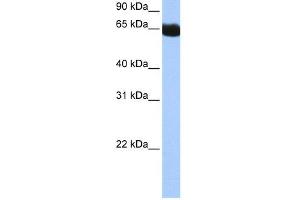 WB Suggested Anti-NSUN6 Antibody Titration:  0. (NSUN6 anticorps  (N-Term))