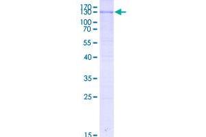 Image no. 1 for Nuclear Factor of Activated T-Cells, Cytoplasmic, Calcineurin-Dependent 1 (NFATC1) (AA 1-716) protein (GST tag) (ABIN1312440)