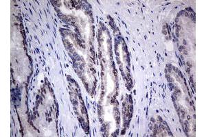 Image no. 7 for anti-TIA1 Cytotoxic Granule-Associated RNA Binding Protein (TIA1) antibody (ABIN1501387) (TIA1 anticorps)