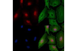 ABIN6257687 and ABIN6274287 staining  cells by IF/ICC. (CEBPG anticorps  (Internal Region))