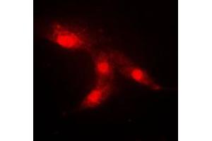 Immunofluorescent analysis of CRABP2 staining in HeLa cells. (CRABP2 anticorps  (Center))