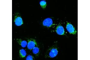 IF analysis of Hexokinase 1/HK1 using anti-Hexokinase 1/HK1 antibody (ABIN7600258). (Hexokinase 1 anticorps  (AA 17-323))