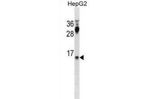 CYYR1 Antibody (C-term) (ABIN1881247 and ABIN2838999) western blot analysis in HepG2 cell line lysates (35 μg/lane). (CYYR1 anticorps  (C-Term))