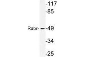 Western blot (WB) analysis of Rabr antibody in extracts from MCF-7cells. (AGFG2 anticorps)