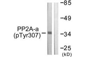 Western blot analysis of extracts from A549 cells, using PP2A-alpha (Phospho-Tyr307) Antibody.