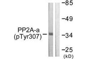Western blot analysis of extracts from A549 cells, using PP2A-alpha (Phospho-Tyr307) Antibody. (PPP2CA anticorps  (pTyr307))