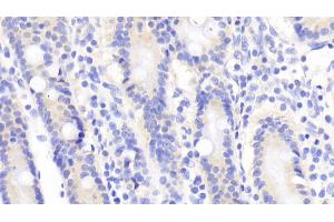 Detection of TRAF1 in Human Small intestine Tissue using Polyclonal Antibody to TNF Receptor Associated Factor 1 (TRAF1)
