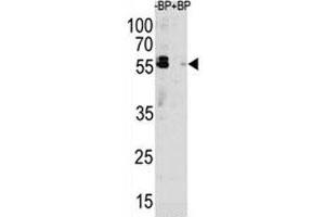Western blot analysis of p62 antibody pre-incubated without (Lane 1) and with (2) blocking peptide in MCF-7 lysate