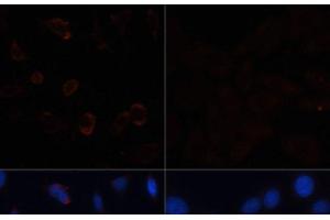 Immunofluorescence analysis of HeLa cells using ACACA Polyclonal Antibody at dilution of 1:100.
