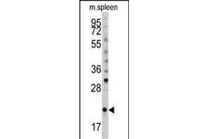 Western blot analysis of anti-mouse BID Antibody (S61) (ABIN388100 and ABIN2846184) in mouse spleen tissue lysates (35 μg/lane). (BID anticorps  (AA 39-68))