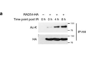 RAD54 acetylation is important for BRD9 recognition and HR activity.