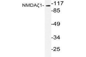 Western blot (WB) analyzes of NMDAζ1 antibody in extracts from Jurkat cells. (NMDA 1 Receptor anticorps)