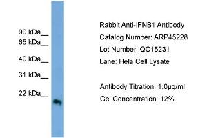 WB Suggested Anti-IFNB1  Antibody Titration: 0. (IFNB1 anticorps  (Middle Region))