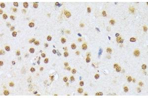 Immunohistochemistry of paraffin-embedded Mouse brain using A1CF Polyclonal Antibody at dilution of 1:100 (40x lens). (A1CF anticorps)
