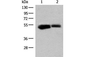 Western blot analysis of Mouse liver tissue and Rat liver tissue lysates using GLUD1 Polyclonal Antibody at dilution of 1:200 (GLUD1 anticorps)