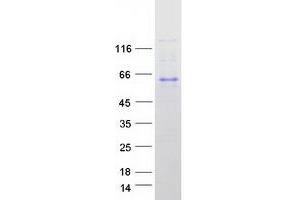 Validation with Western Blot