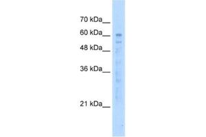 Western Blotting (WB) image for anti-EF-hand calcium binding domain 14 (EFCAB14) antibody (ABIN2463041) (KIAA0494 anticorps)