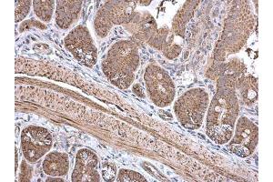 IHC-P Image ECH1 antibody [N1C3] detects ECH1 protein at cytoplasm in mouse intestine by immunohistochemical analysis. (ECHS1 anticorps)