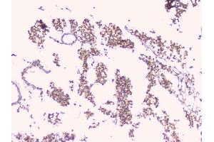 IHC analysis of TNFRSF11B using anti-TNFRSF11B antibody (ABIN7600875).
