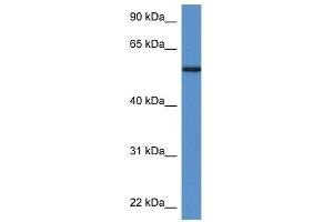 Western Blot showing PGM5 antibody used at a concentration of 1 ug/ml against Fetal Heart Lysate (Phosphoglucomutase 5 anticorps  (N-Term))