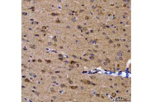 IHC analysis of GRB10 using anti-GRB10 antibody (ABIN7599160). (GRB10 anticorps  (AA 1-251))
