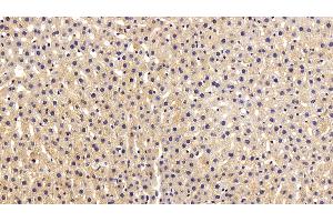 Detection of FGF2 in Rat Liver Tissue using Polyclonal Antibody to Fibroblast Growth Factor 2, Basic (FGF2) (FGF2 anticorps  (AA 159-288))